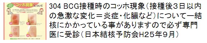 304 BCG接種時のコッホ現象（接種後３日以内の急激な変化＝炎症・化膿など）についてー結核にかかっている事がありますので必ず専門医に受診（日本結核予防会H２５年９月）